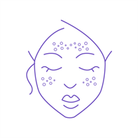 АТОПИЧЕСКИЙ ДЕРМАТИТ