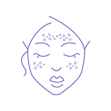 АТОПИЧЕСКИЙ ДЕРМАТИТ